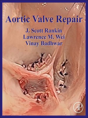 cover image of Aortic Valve Repair